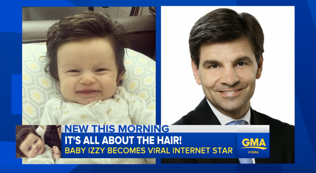 Illustration for article titled This Very Hairy Baby Scares Me and I Feel Bad About That